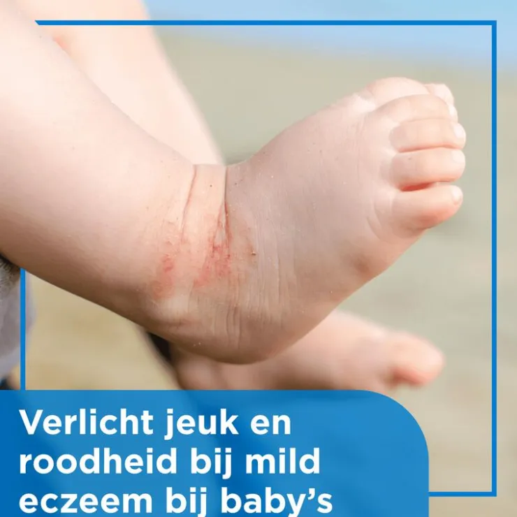 Bepanthen Eczeem Crème Baby Verlicht Jeuk En Roodheid Bij Mild Tot Matig Eczeem 20 GR