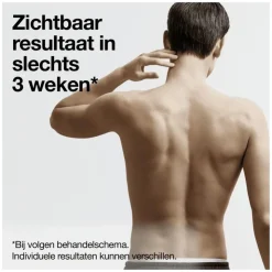 Heren Braun IPL Silk-expert Pro 5 PL5145