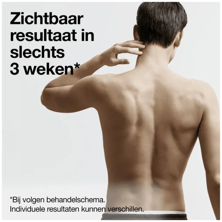 Heren Braun IPL Silk-expert Pro 5 PL5145