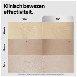 Heren Braun IPL Silk-expert Pro 5 PL5145