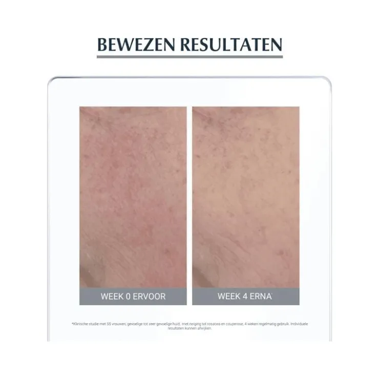 Eucerin AntiREDNESS Corrigerende Crème 50 ML