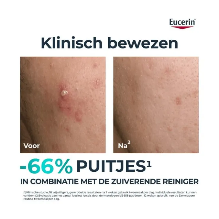 Eucerin DERMOPURE CLINICAL Triple Action Fluid Serum Gevoelige Huid 40 ML