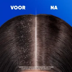 Head and Shoulders Head & Shoulders Apple Fresh Anti-Roos Shampoo 300 ML