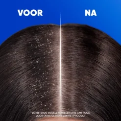 Head and Shoulders Head & Shoulders Classic Anti-roos Shampoo 625 ML