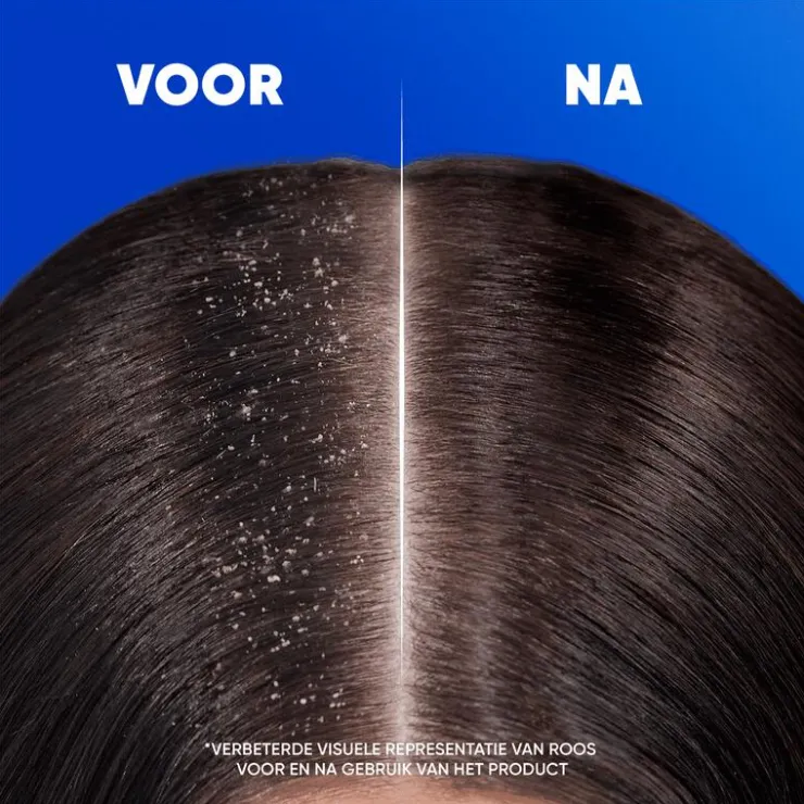 Head and Shoulders Head & Shoulders Classic 2in1 Anti-roos Shampoo & Conditioner 300 ML