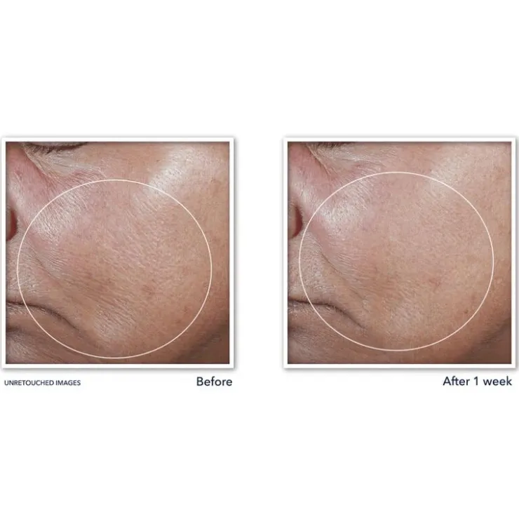 RoC Derm Correxion Firming Serum Stick