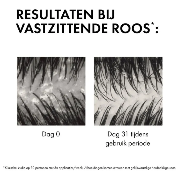 Vichy Dercos Anti-Roos DS Shampoo NH/VH Navulling 390 ML