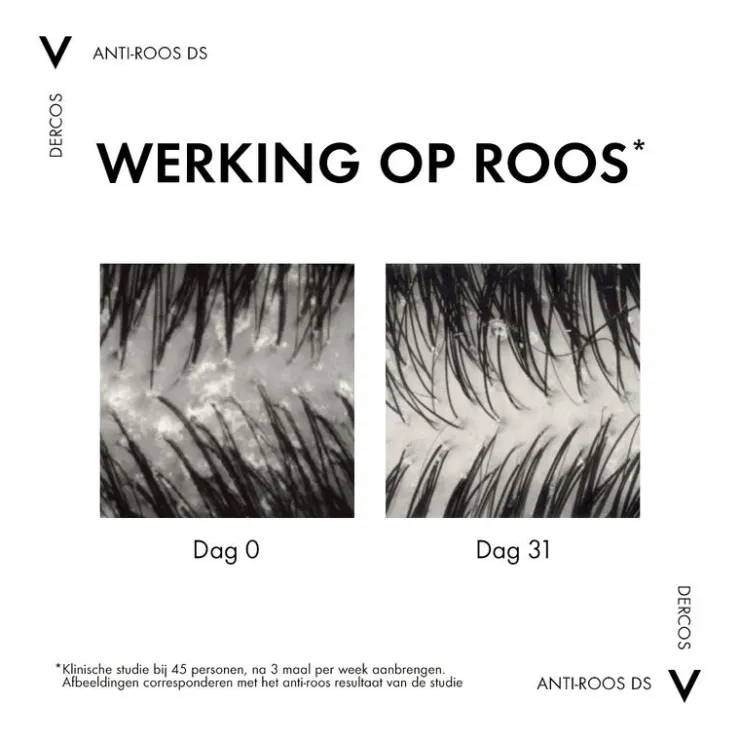 Vichy Dercos Anti-Roos Shampoo Droog Haar 390 ML